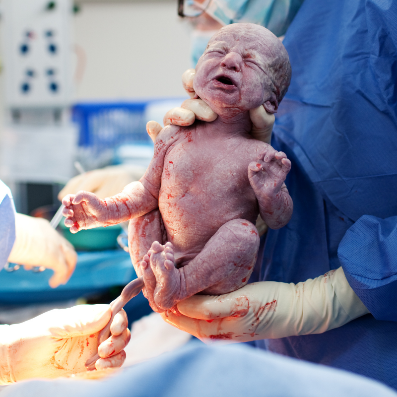 What Are The Risks And Benefits Of C-Section Birth?